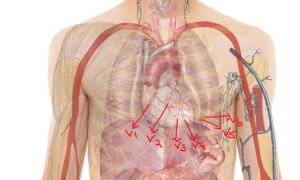 eduAcute Medical Simulation Solutions (EMate)